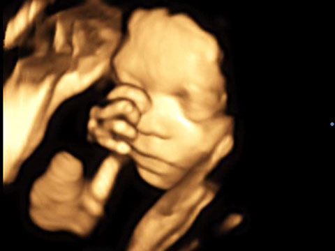 Baby 4D Ultraschall