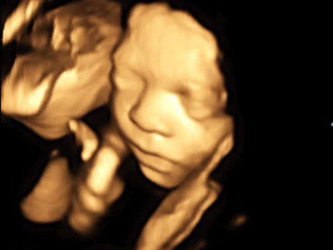 Baby 4D Ultraschall