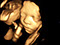 Baby 4D Ultraschall